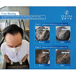 YENEDA - NMN15000+ 逆齡の髮 60粒裝